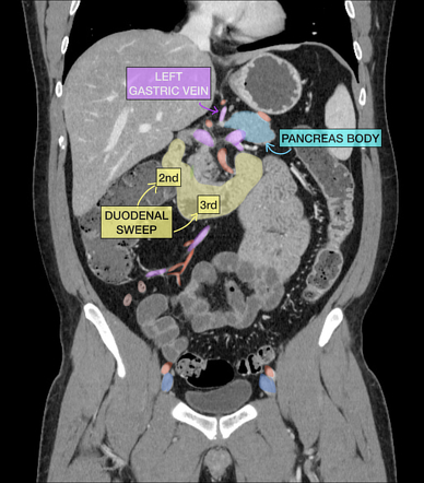 scanner abdominal