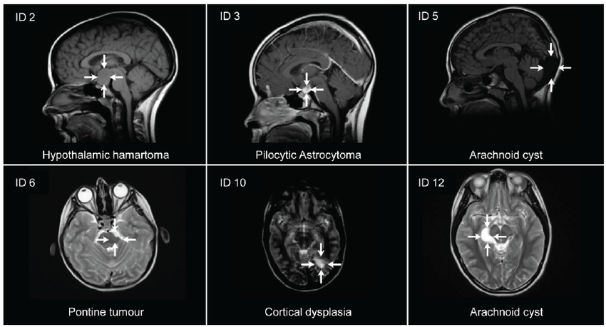 pathologie