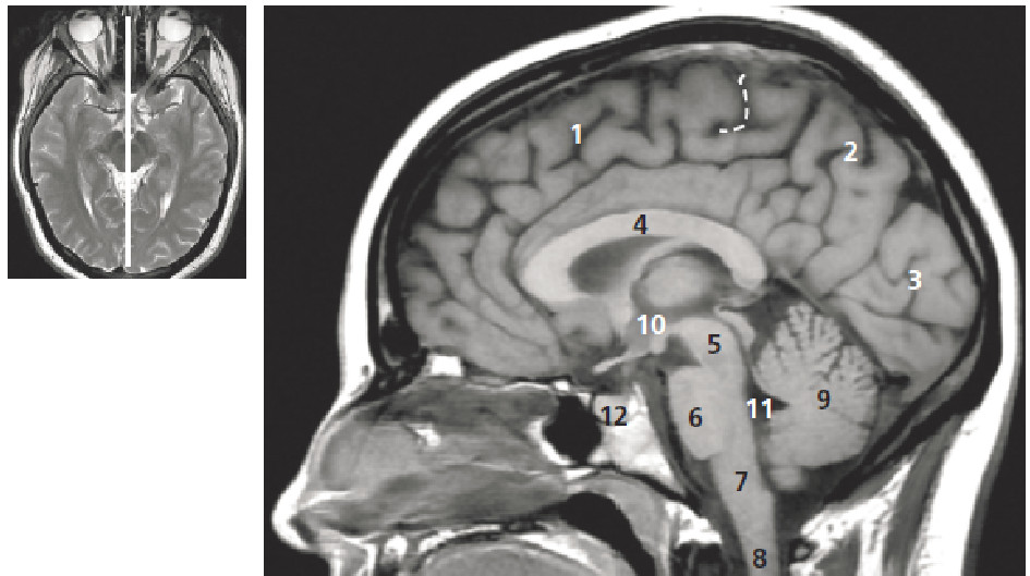 cerveau