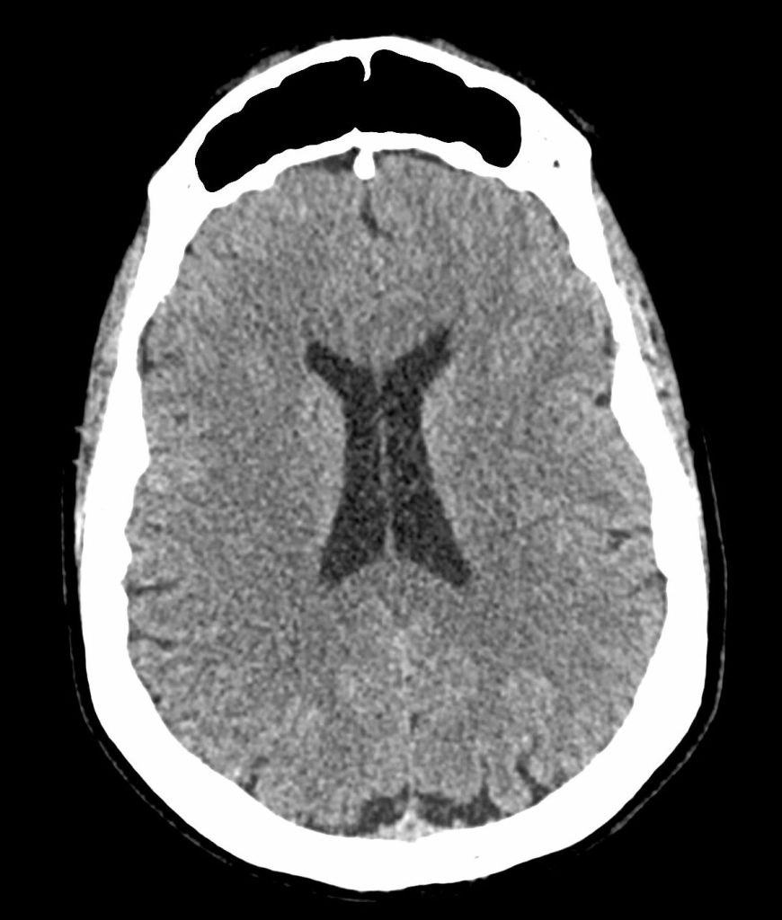 cerveau scanner
