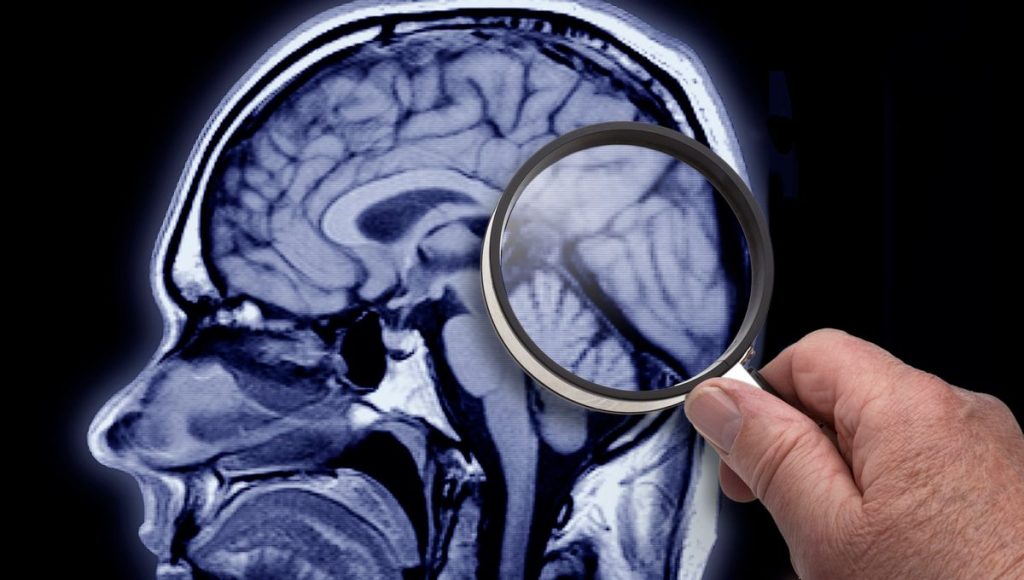 pathologies dégénératives