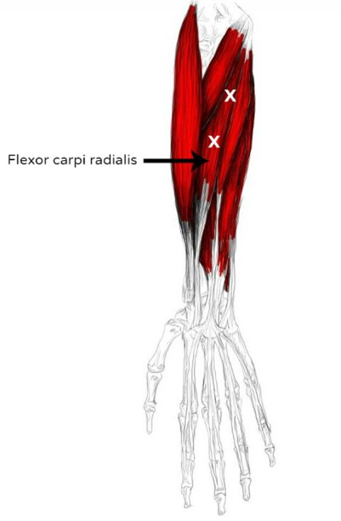Fléchisseur radial du carpe 