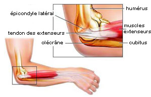 epicondyle latéral