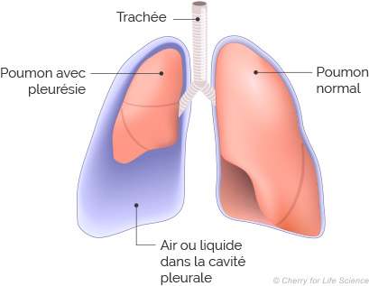 pleural