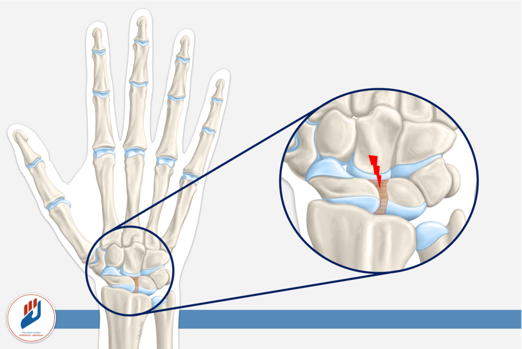 Anatomie du poignet