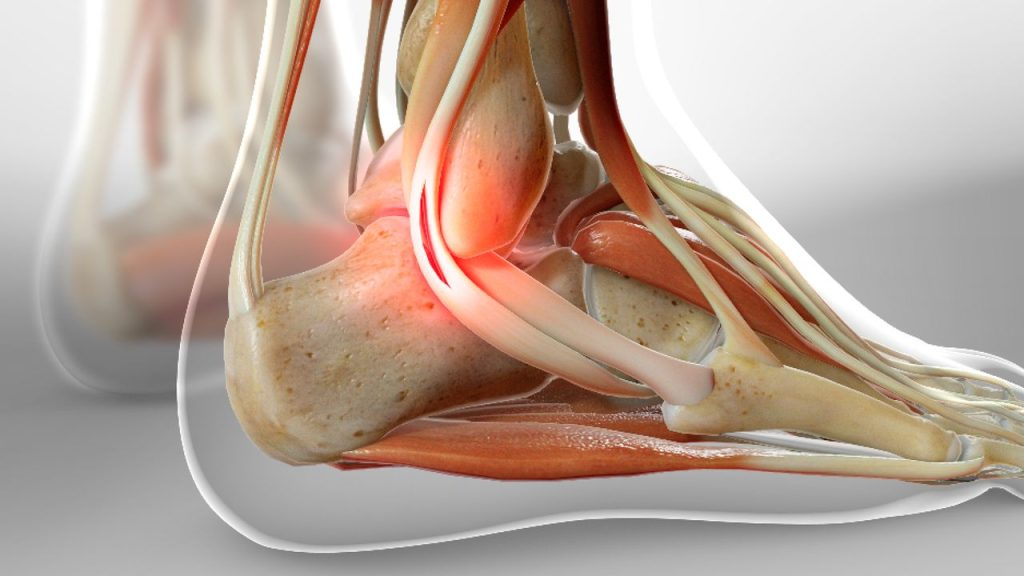 Anatomie des tendons fibulaires de la cheville
